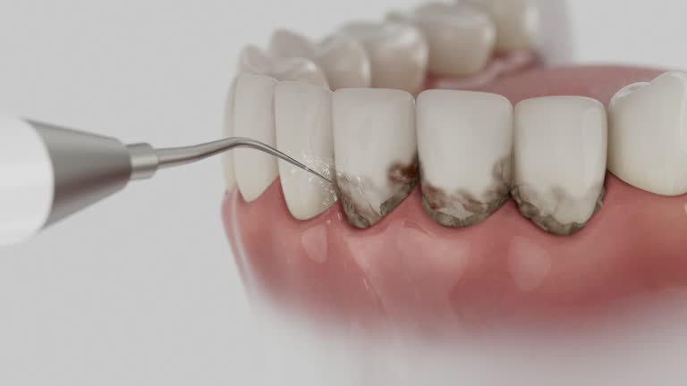 Reliable Emergency Dentist contractor in Markesan, WI by Smile Center Dentistry